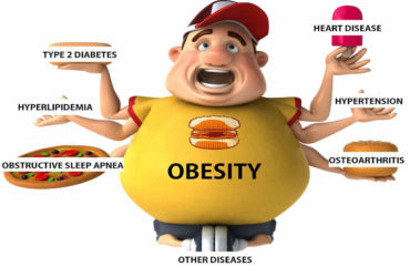Assignment Help on obesity